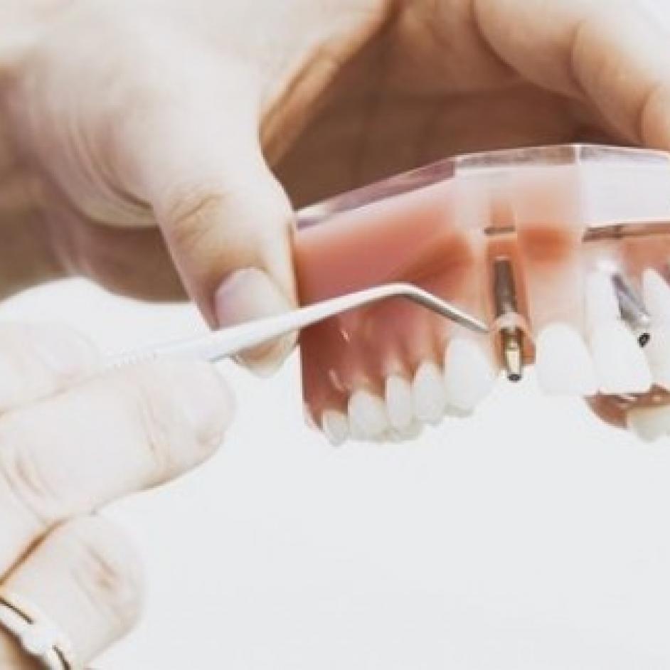 The advantages, possibilities and care of dental prosthetics