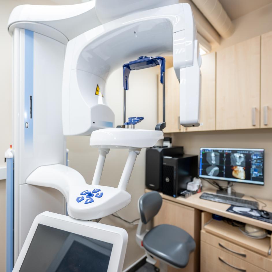 Vienmomenė implantacija Vienmomenė implantacija